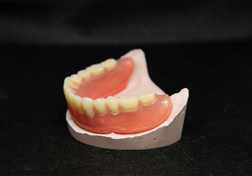 レジン床義歯（保険診療の総入れ歯）