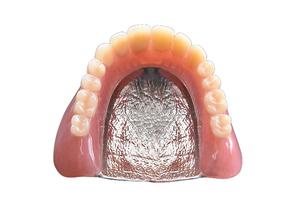 金属床義歯（自由診療の総入れ歯）