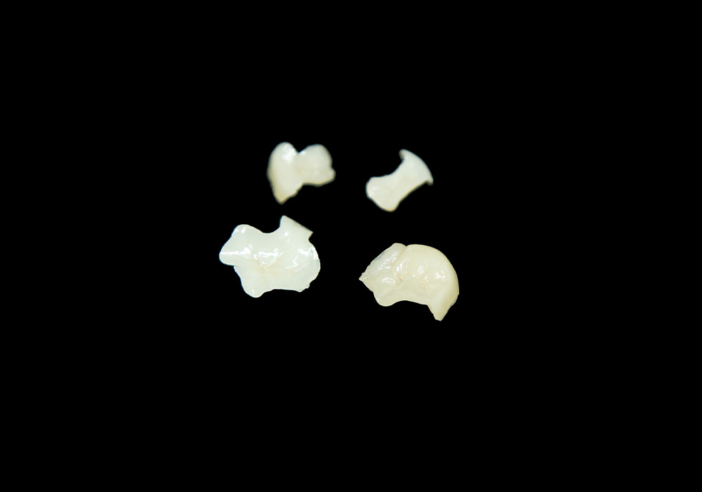 セラミックの詰め物・被せ物