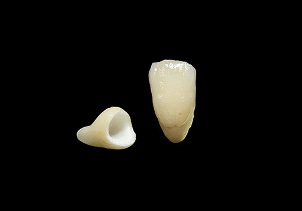 ジルコニアの詰め物・被せ物