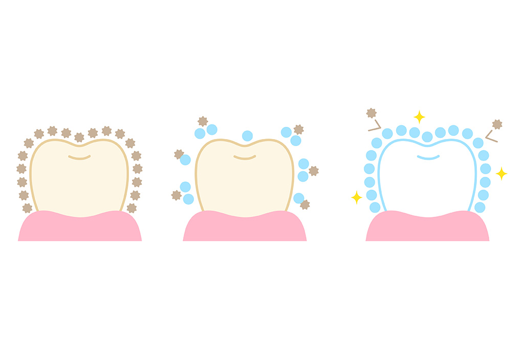 ホームホワイトニング